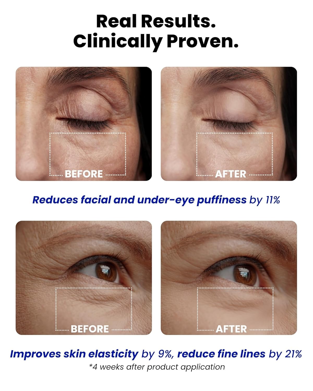 Ice Roll Serum | Cooling & Hydrating Roll-On Serum for Face, Puffy Eyes, Bakuchiol & Collagen for Firming & Lifting, Facial Roller for Depuffing, Under Eye Bag Treatment | Korean Skin Care