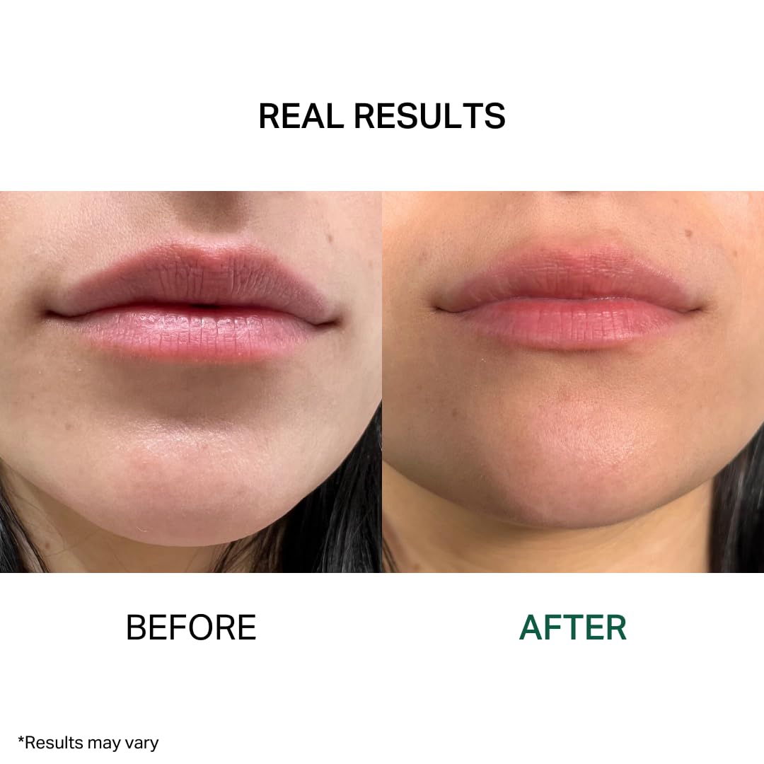 Y’OUR Intensive Lip Balm | Overnight Lip Mask: Lightweight & Comforting with Natural Shea Butter & Rosehip Oil; Extreme Moisturizer for Dry Lips. Paraben & Silicon-Free. Made in USA. 15ml (0.5 oz.)