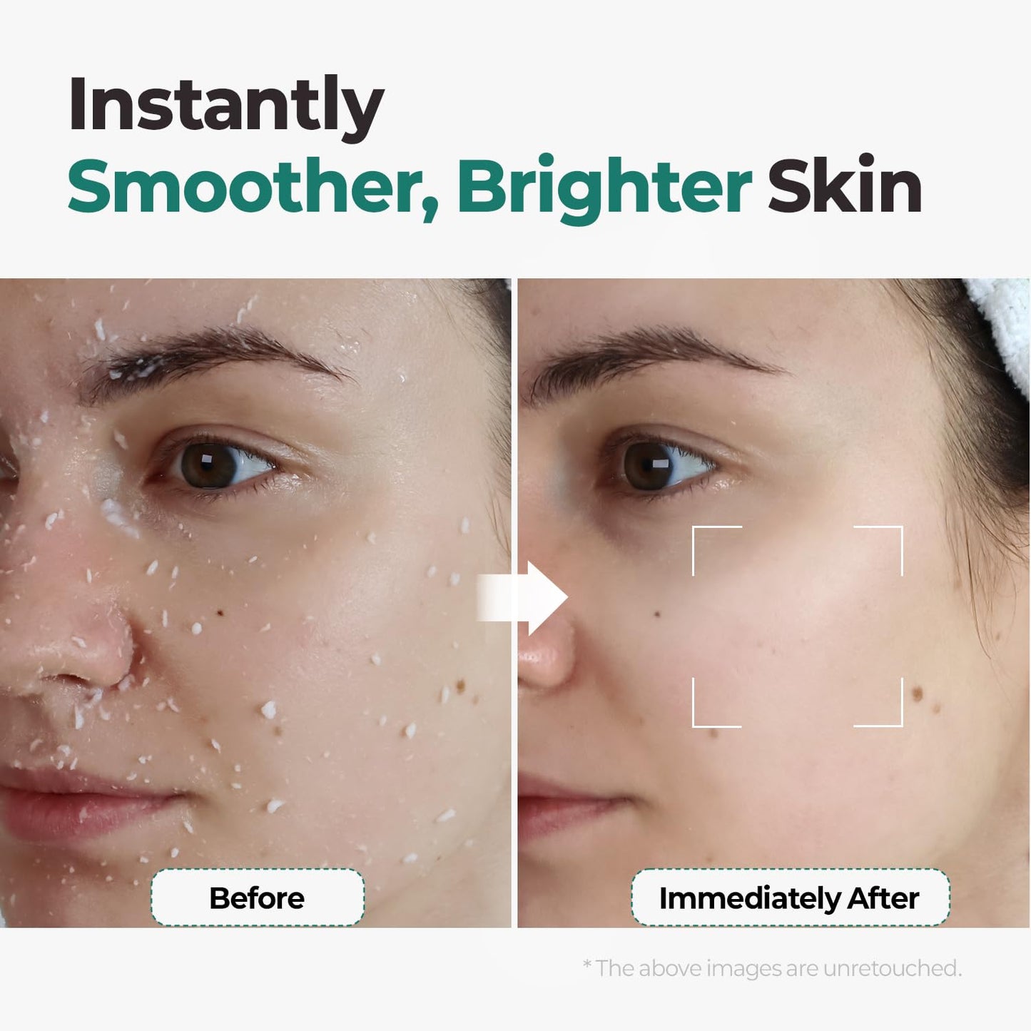 MOTHER MADE LHA Green Tea Exfoliating Aqua Peel Gel, Pore Care, Gentle Facial Exfoliator, Dead Skin Remover, Natural Cellulose for Peeling, Vegan, Korean Skincare, 2 Pack (100ml / 3.38 fl.oz)