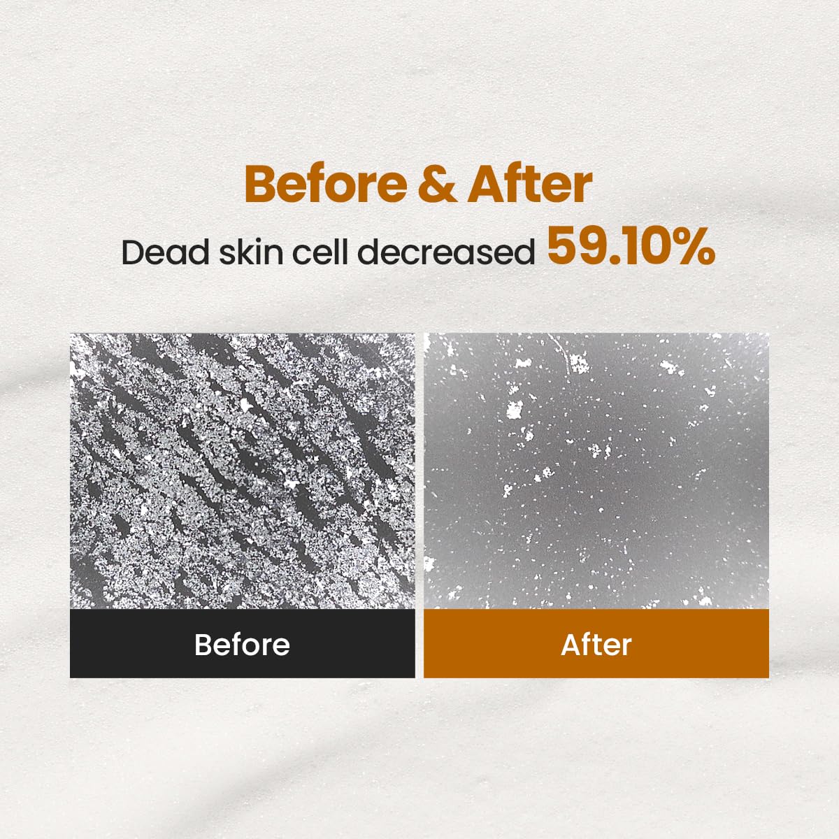 Enzyme Cleansing Powder – 40g (1.41 oz) – Purifies Pores, Removes Blackheads & Whiteheads, With Papain Enzyme for Smooth & Clear Skin | Low pH, Non-Irritating, For Sensitive Skin