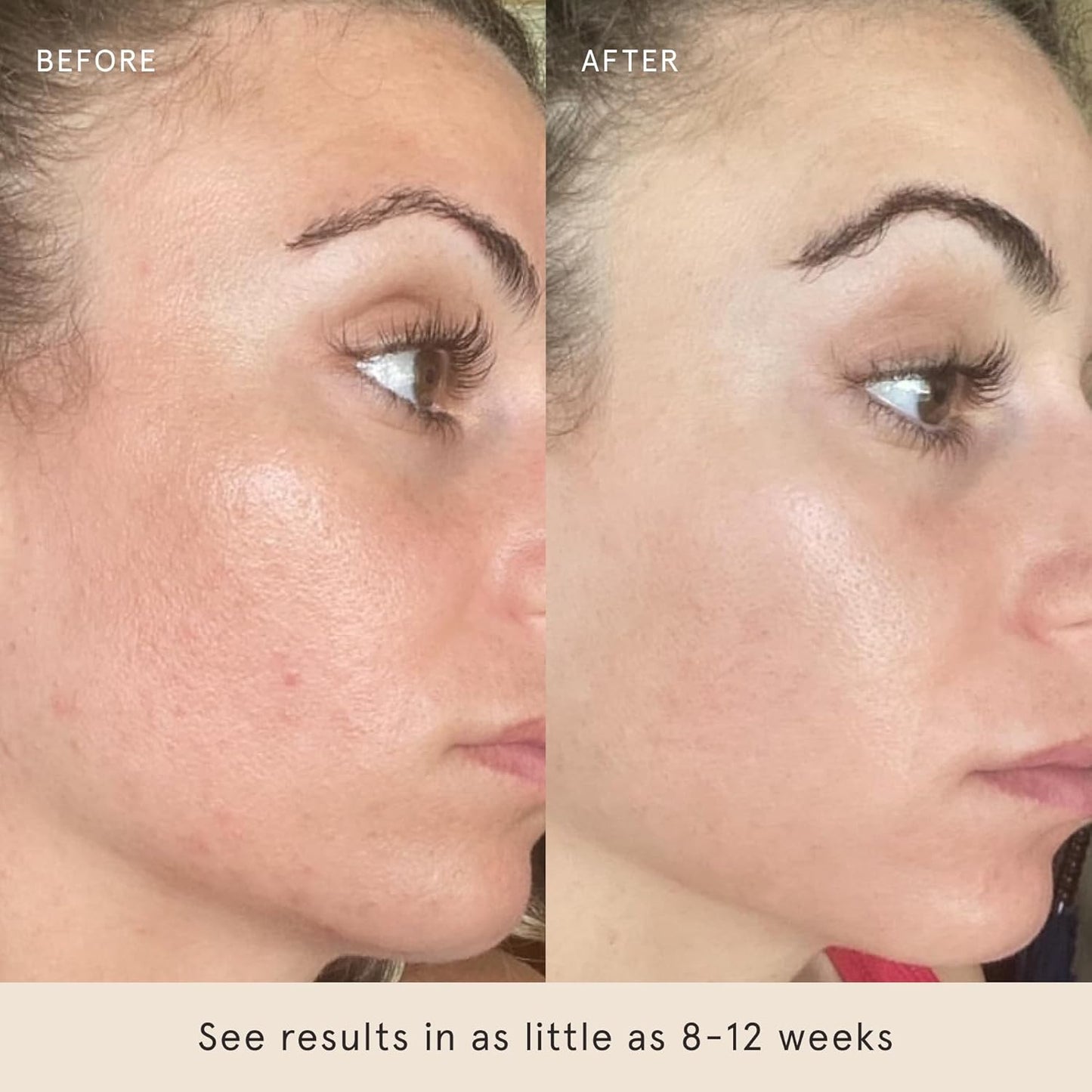 Barefaced Liquid Gold 1 Fl Oz - 15% Vitamin C Serum with Hyaluronic Acid & Vitamin E for Anti-Aging, and Hydration, Antioxidant Formula, Reduces Dark Spots, Acne & Wrinkles