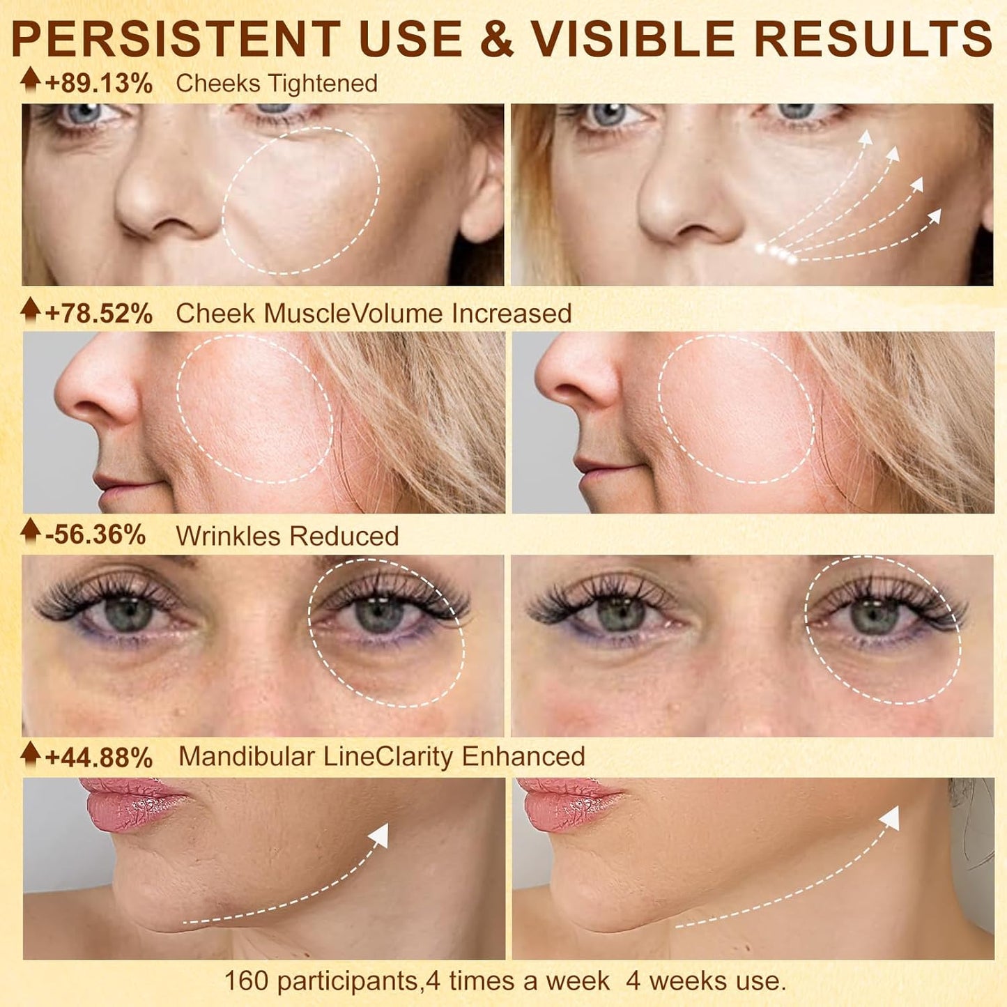 Microcurrent Facial Device,Radio Frequency Skin Tightening Face Machine Treatment of Facial Wrinkles and mild to Moderate inflammatory