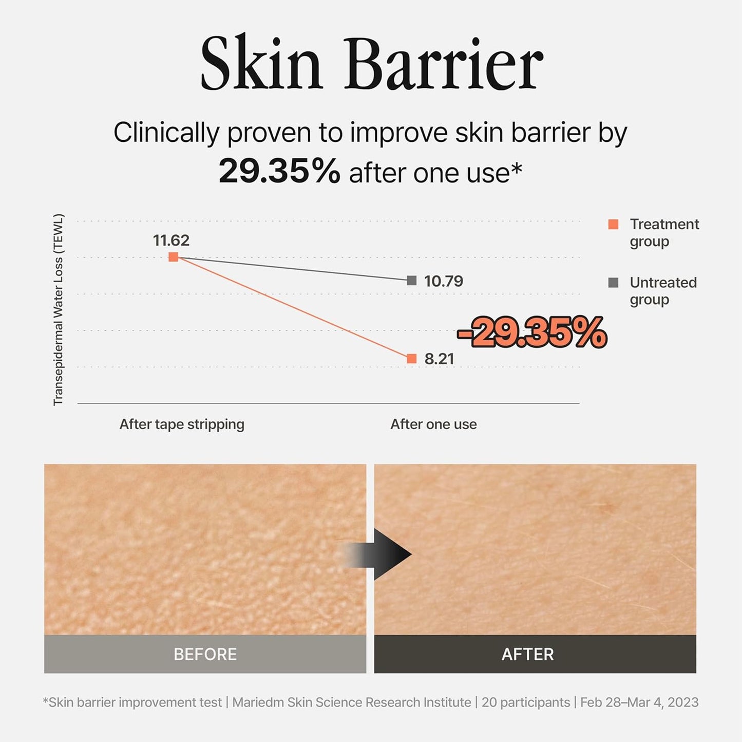 Silver Frost Mist - Facial Barrier Toner Spray with 80% Witch Hazel Water, Cica for Skin Barrier Repair, Recovery for Sensitive Skin, Dewy Hydration, Korean Skin Care (1.69 fl oz)