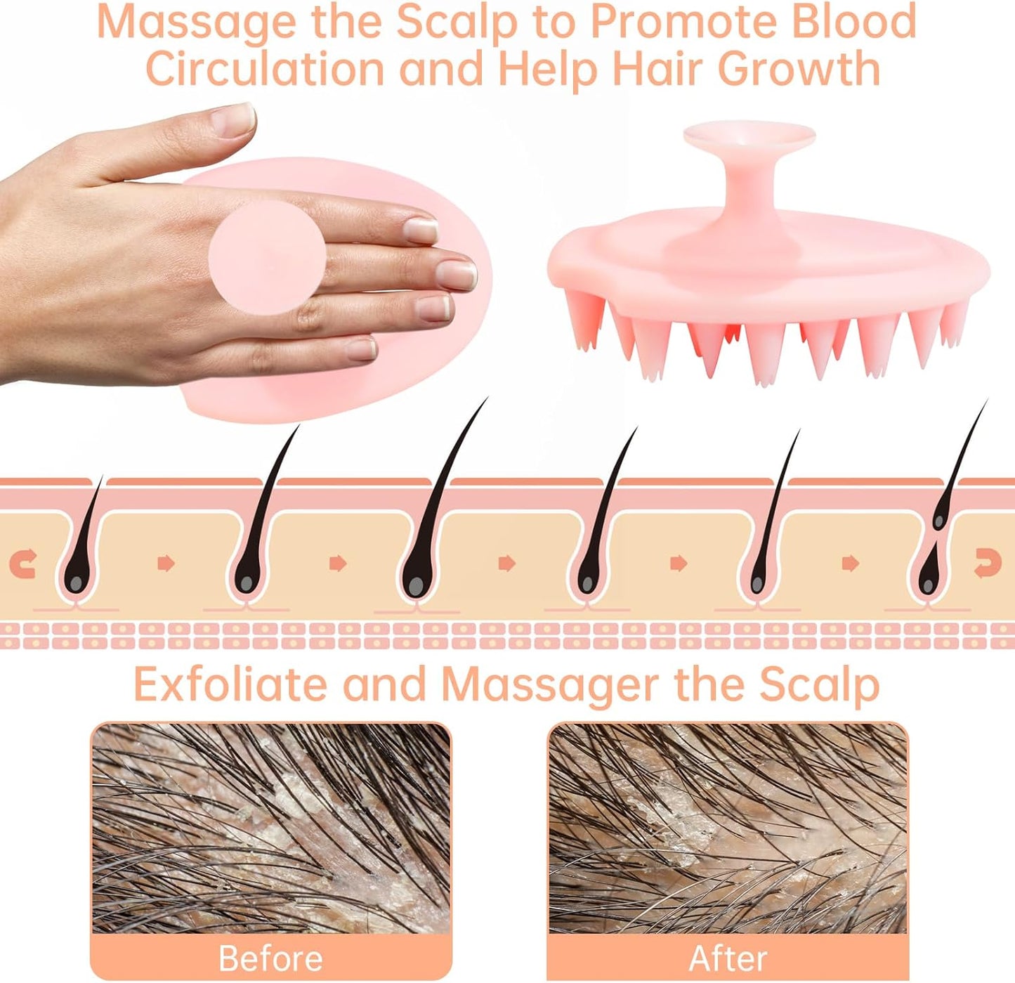 DUAIU Scalp Massager Shampoo Brush with Head Scalp Comb, Silicone Scalp Scrubber Gua Sha Comb for Women Men Hair Growth Dandruff Removal, Head Massage Brush Comb Set Gift, Pink