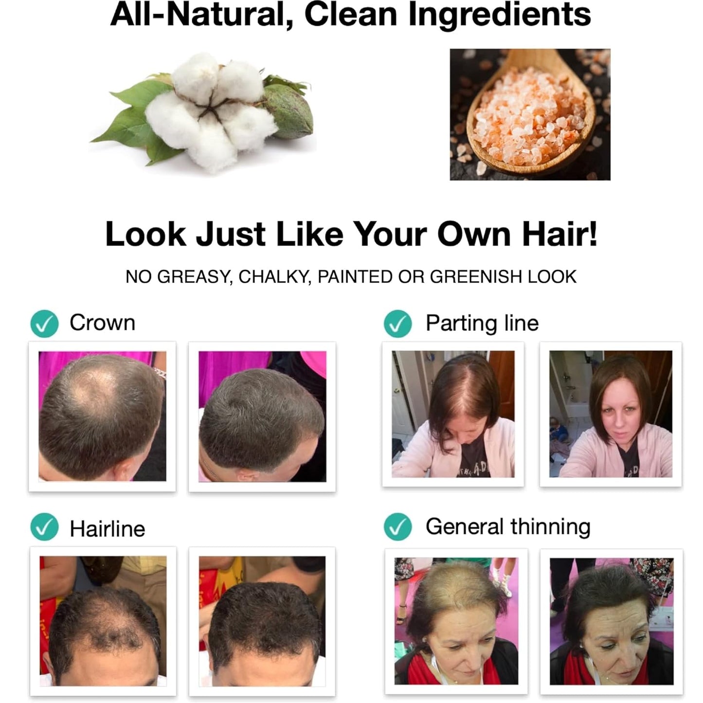 Caboki Hair Loss Concealer. All-Natural Hair Building Fiber. Make Thin Hair Look 10X Fuller Instantly. Eliminate the Appearance of Bald Spot and Thinning Hair (30G, 90-Day Supply). Golden Blonde