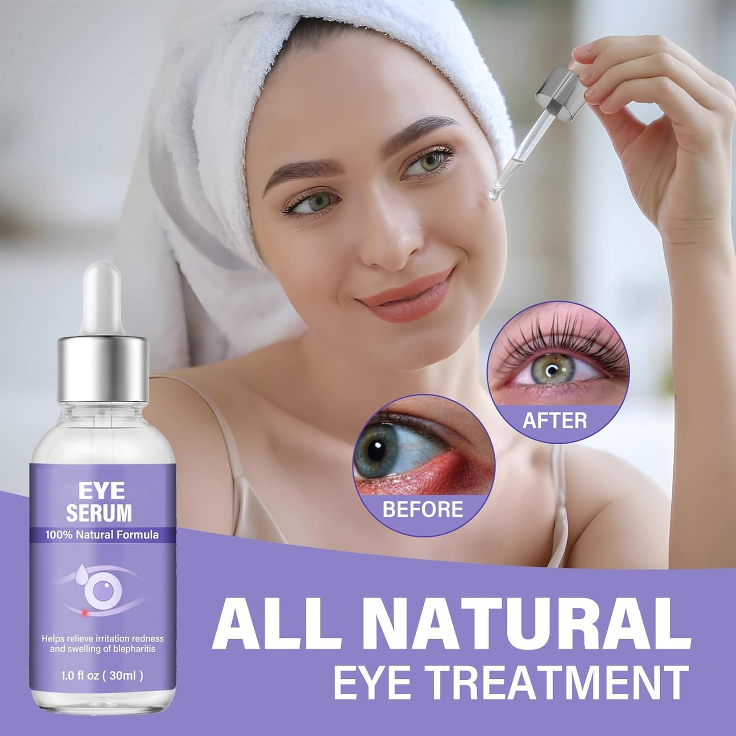 Eye Serum, Mild Eye Treatment for Styes Chalazḭon and Blepharḭtis Ṫreatment, Natural Lash and Eye Cleanser- Regain Healthier Eye Skin, 1 Fl.oz