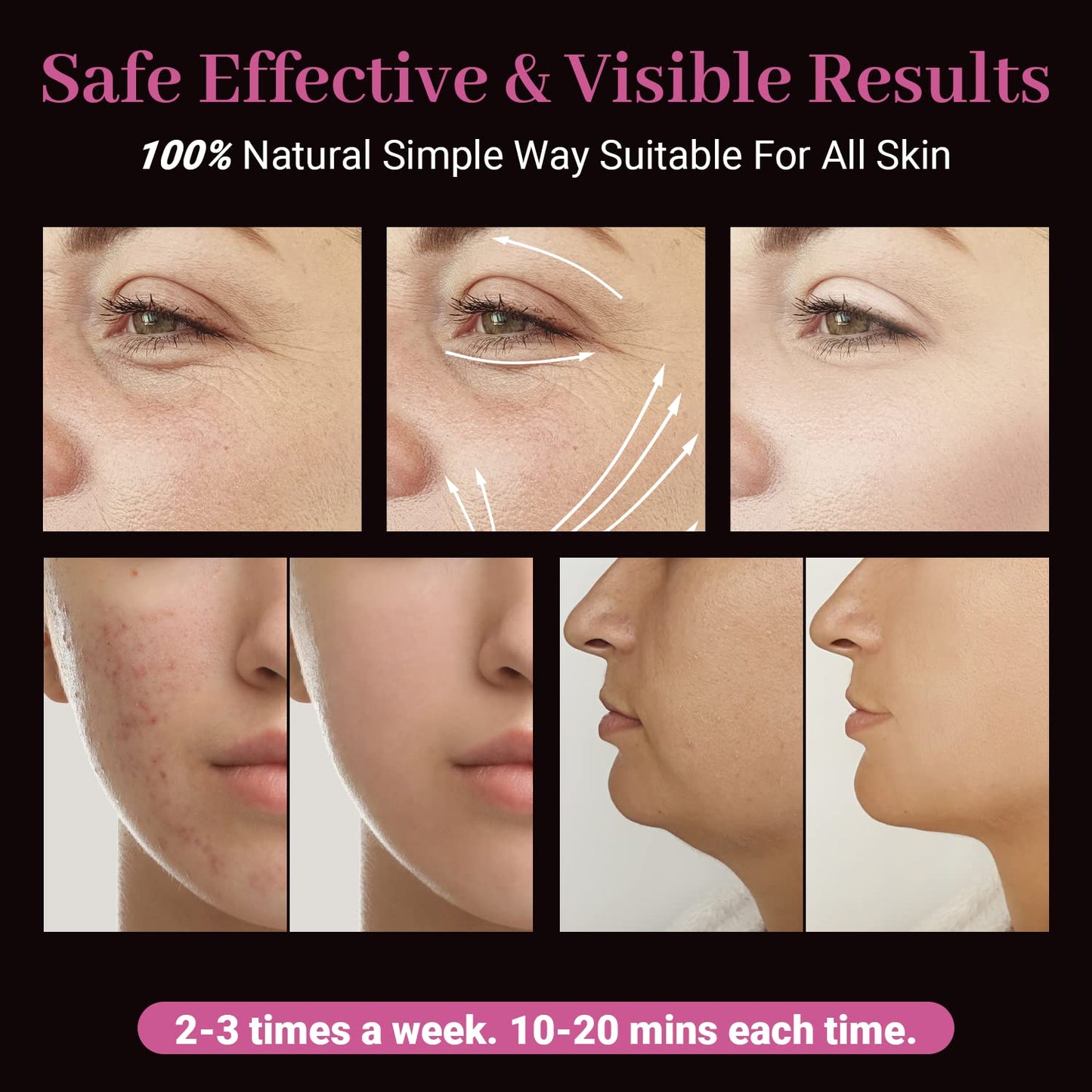 High Frequency Facial Wand - UUPAS Portable Handheld High Frequency Facial Skin Machine with 4 Pcs Orange Glass Tubes