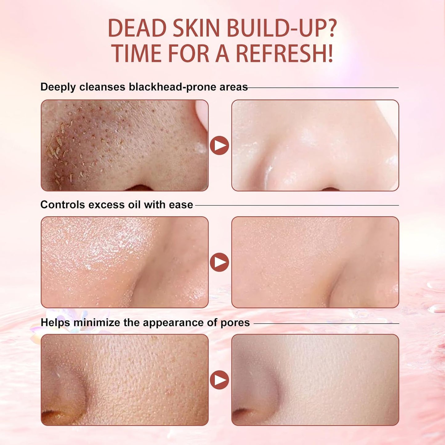 Purifying Exfoliating Gel, Natural Exfoliating Purifying Cream, Facial Exfoliator Cleanser, Gentle Face Wash-Cleansing Moisturizing Peeling Gel, For All Skin Types (1.76 Fl Oz (Pack of 1))