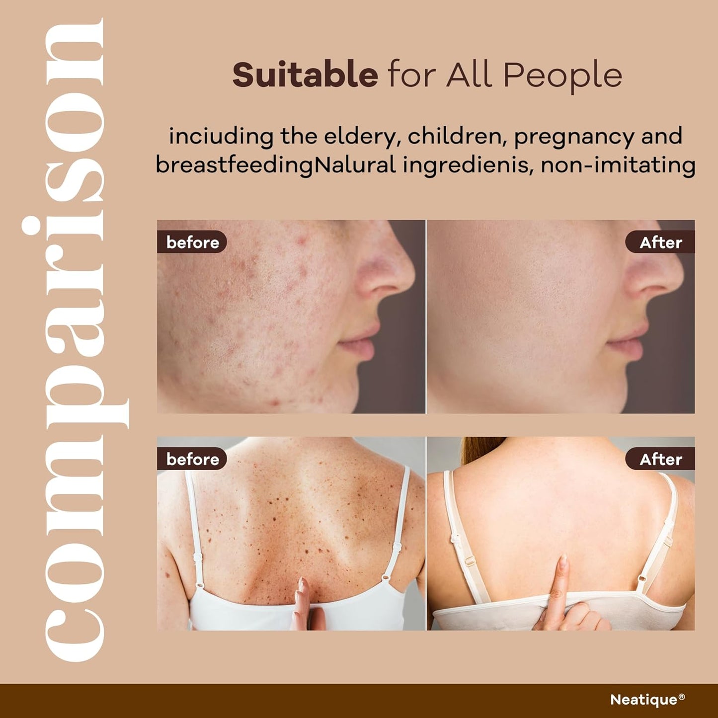 Bee Venom & Hyaluronic Acid Anti-Aging Face Cream – 2025 New Renewal Formula, Skin Moisturizer, All Skin Types, 2.12 Oz (60g)