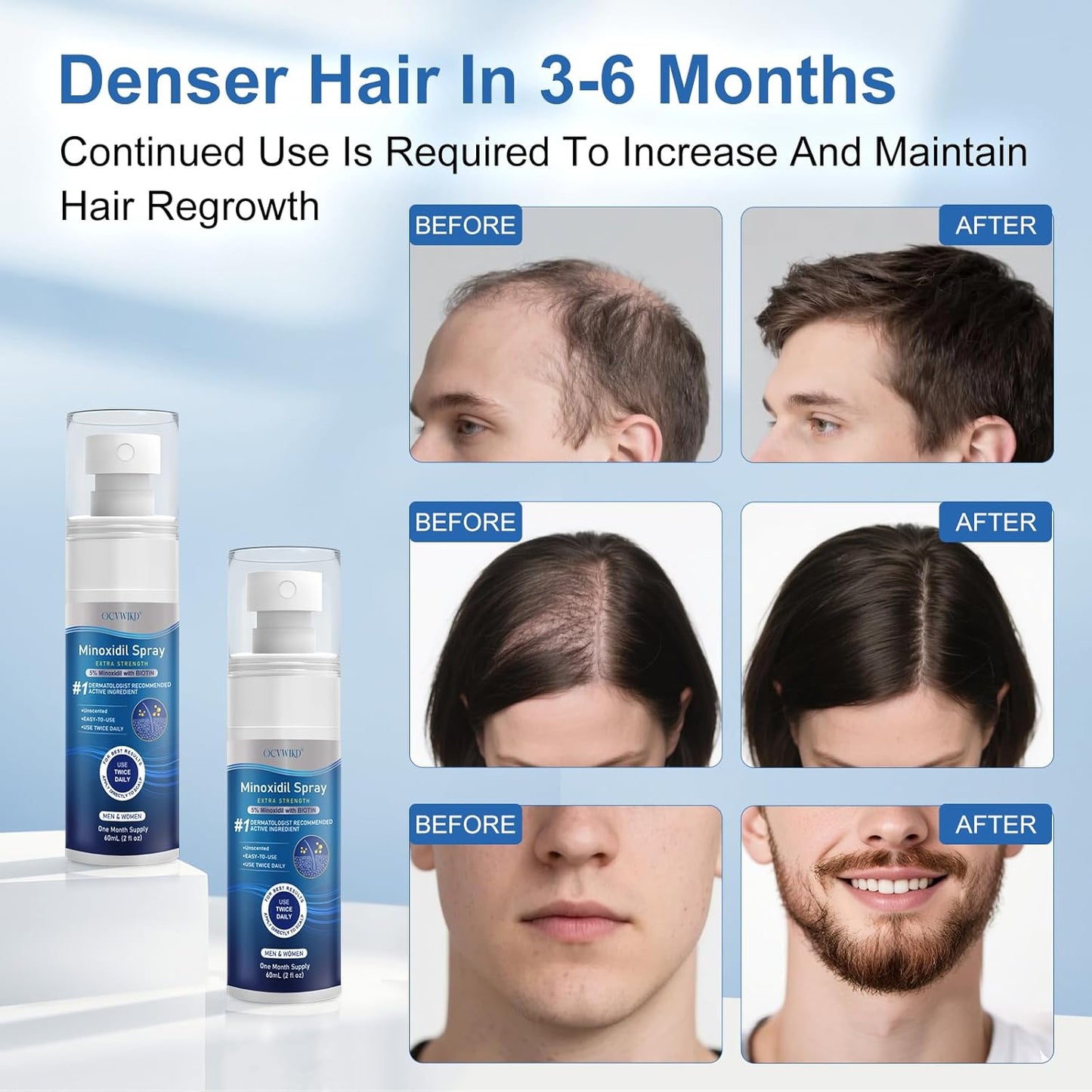 5% Minoxidil for Men and Women, Regrowth Serum, Extra Strength Spray for Hair Loss, Minoxidil 5 Percent, Thicker Healthier Hair, Beard Growth Kit, Topical Treatment, 60ml x 7 Bottles（Extra Strength）