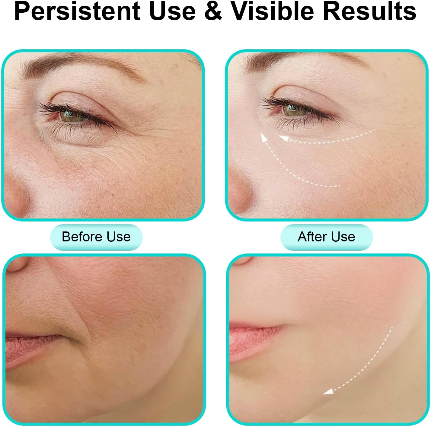 Face Massager, Facial Neck Care Tool with Vibrating Heating Mode, Portable Handheld Gift White