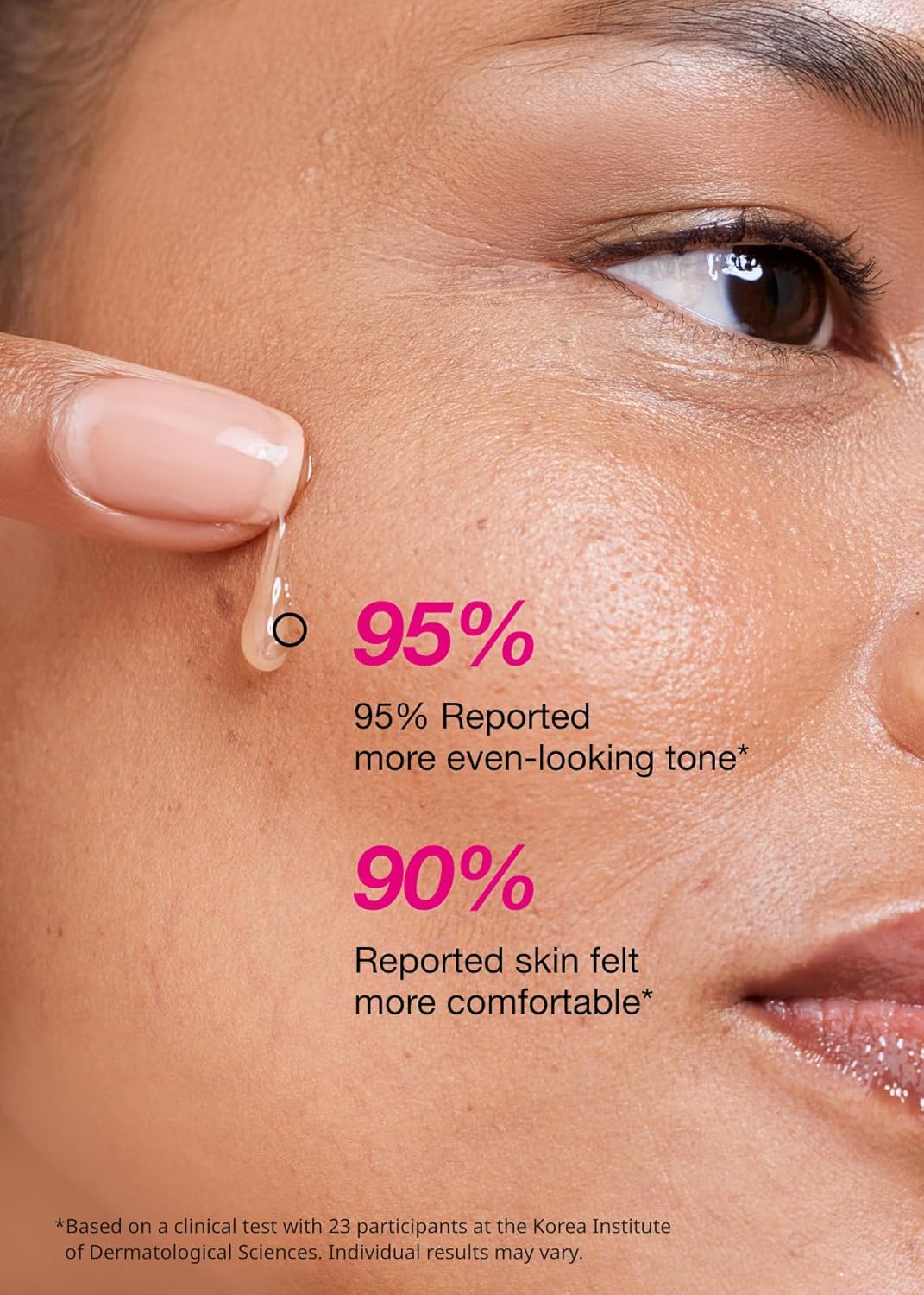 ISOI Blemish Care Up Serum for Face, Vegan Hydrating Serum for Smooth & Glass Skin Effect, Skin Barrier & Moisture Balance for Women, Arbutin, Korean Skin Care (1.18 fl. oz, 35ml)