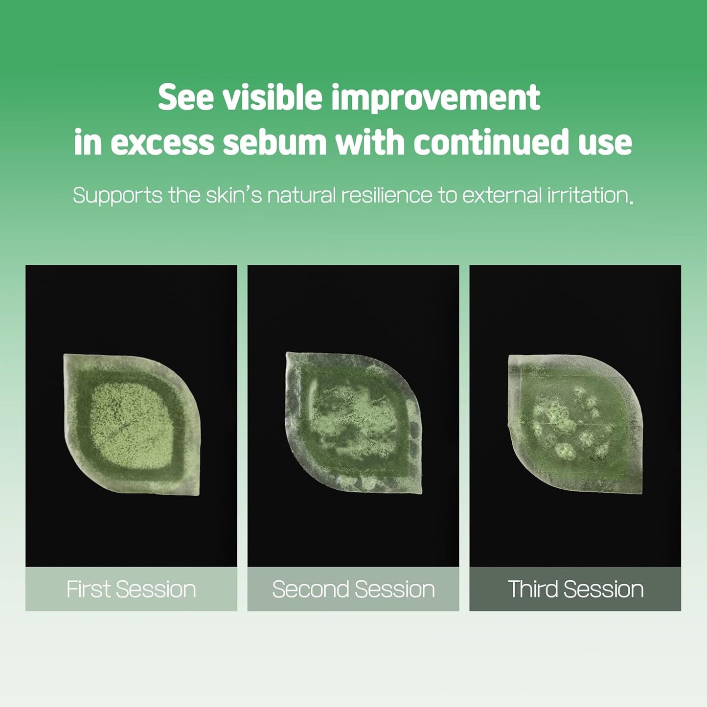 Cica Bio Spot Control Patch (1 Box, 62pcs) | Soothing Acne Patch for Redness & Blemishes | With Cica, Niacinamide & Tea Tree | Gentle for Sensitive Skin | Korean Skincare