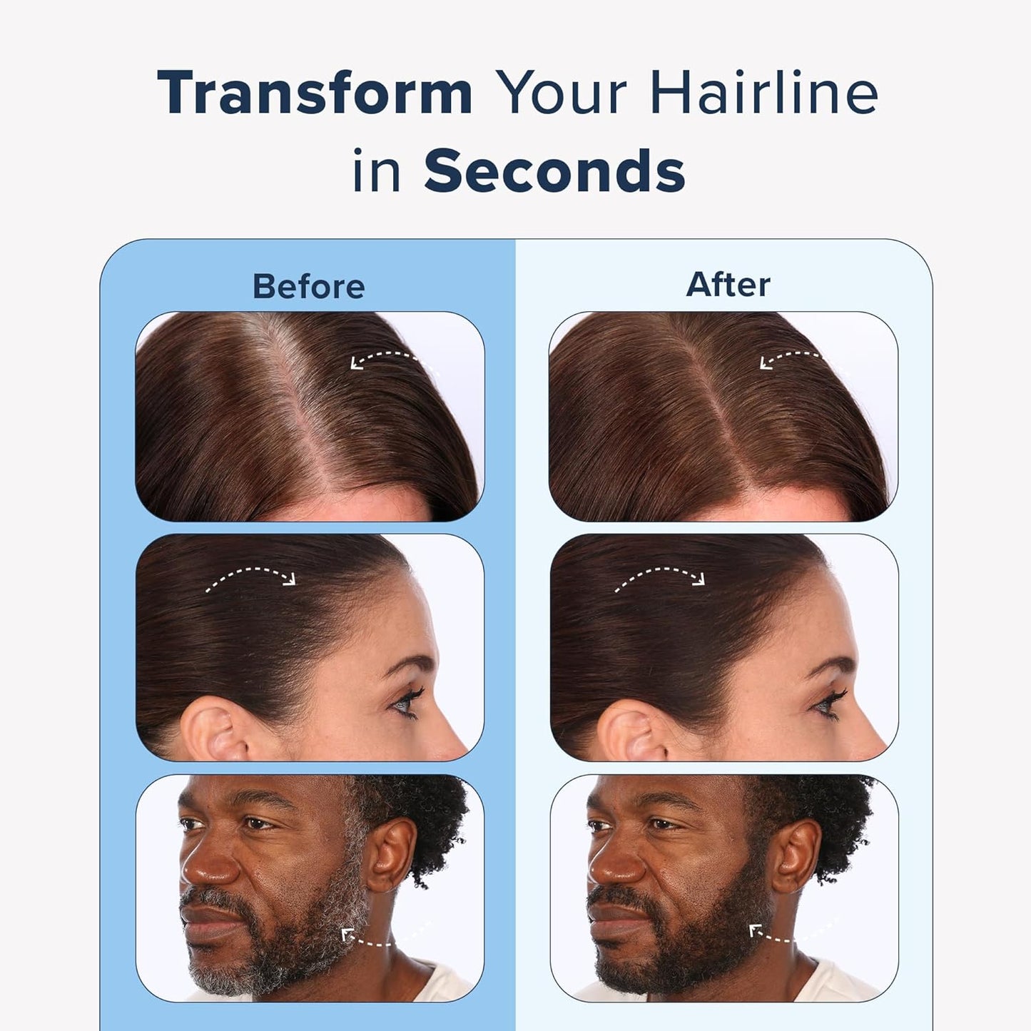 TRUHAIR Color & Conceal Waterproof Root Touch Up - Hair Cover Up for Gray Coverage and Hairline Filling - 11 Colors Available (Auburn)