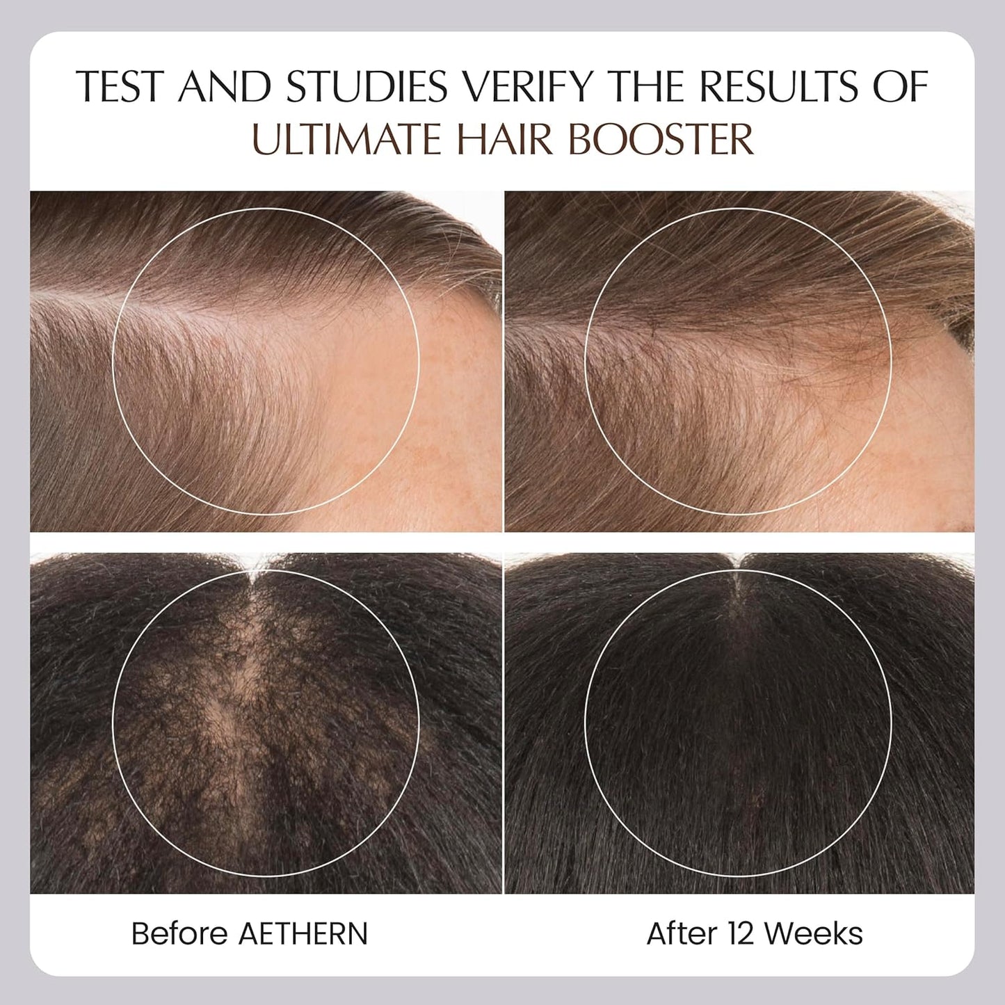 Liquid Hair Growth Supplement with Biotin. Ready-to-Drink. Clinically Proven for Stronger and Shinier Hair, Less Shedding, + Scalp Coverage. Anti-Hair Loss. 28 Servings Ultimate Hair Booster