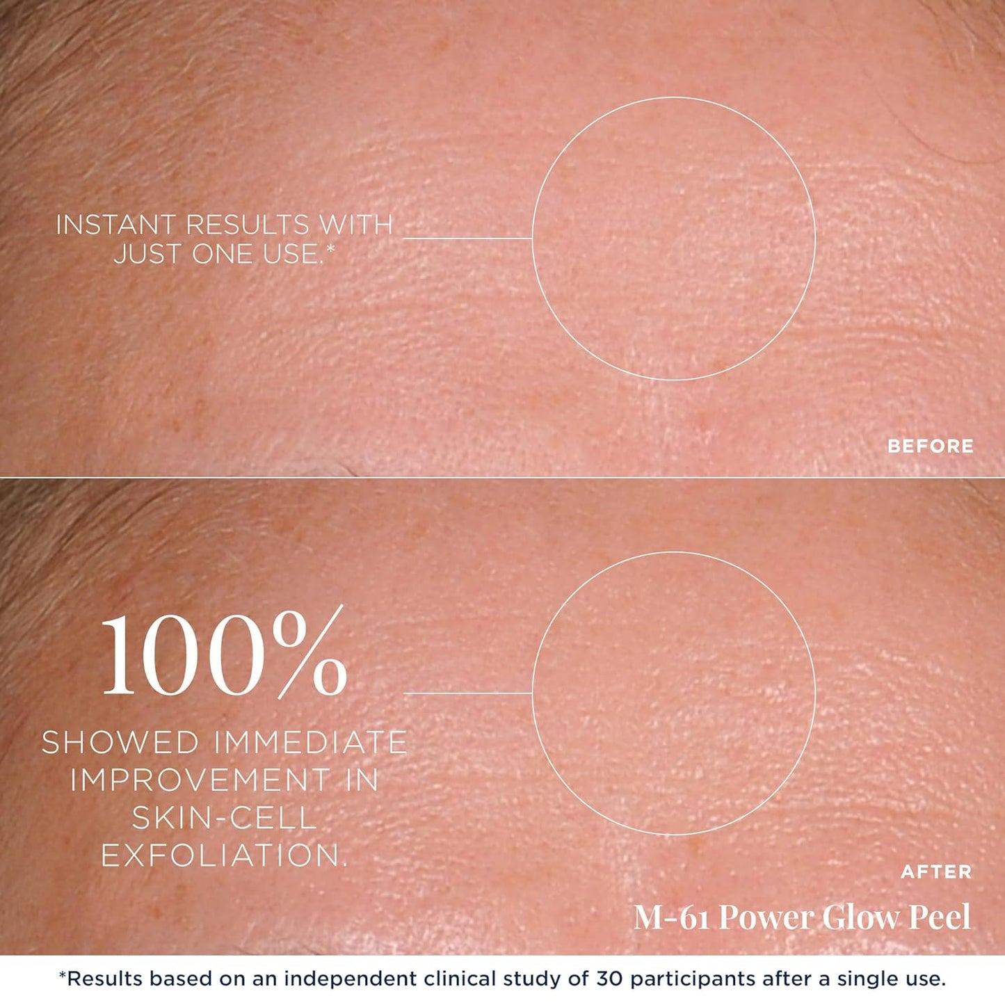 m-61 PowerGlow Peel | Exfoliating Facial Peel With Glycolic, Salicylic Acid. 1 Minute, 1 Step - 60 Treatments