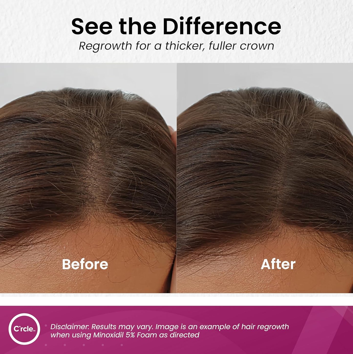 C'rcle Minoxidil for Women 5% Foam - Helps Restore Top of Scalp Hair Loss and Support Hair Growth for Women, Regrowth with Unscented Topical Treatment for Thinning Hair (5% Foam 4-Month Supply)