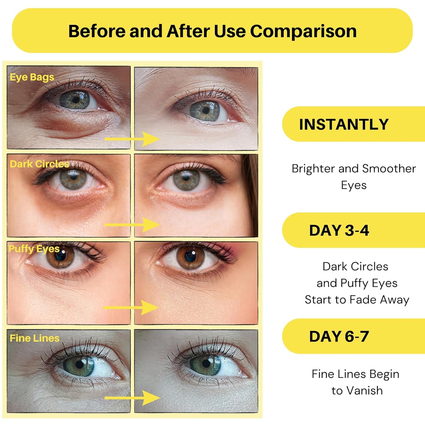 Under Eye Patches - 60 Pcs - Anti-Aging Collagen Eye Mask for Dark Circles, Puffiness & Wrinkles, Refreshes Skin