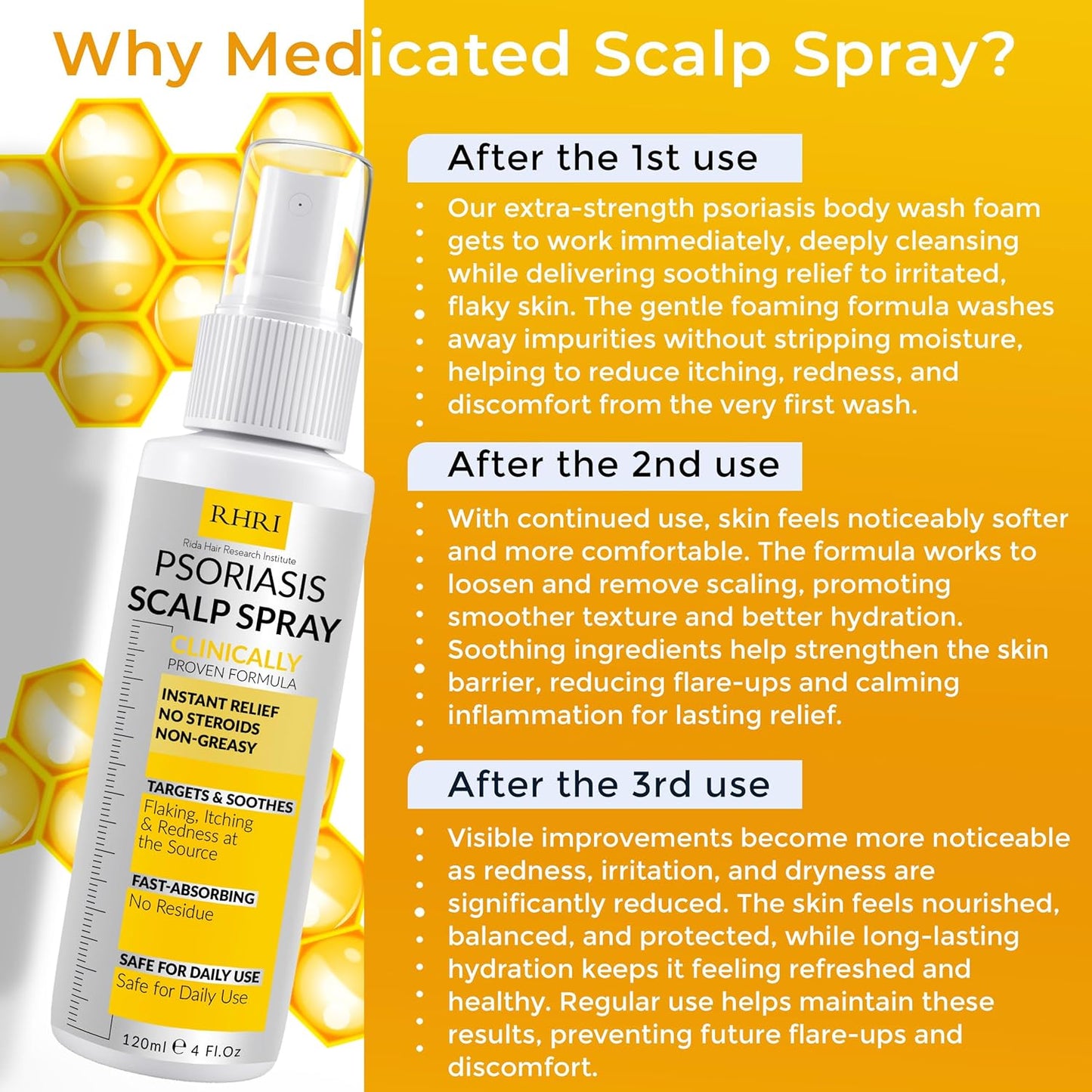 Psoriasis Scalp Spray | Psoriasis and Dandruff Treatment for Scalp Yeast Infections, Psoriasis Flare-Ups & Folliculitis | Antifungal Ringworm Itchy Scalp Spray for Psoriasis, Dryness