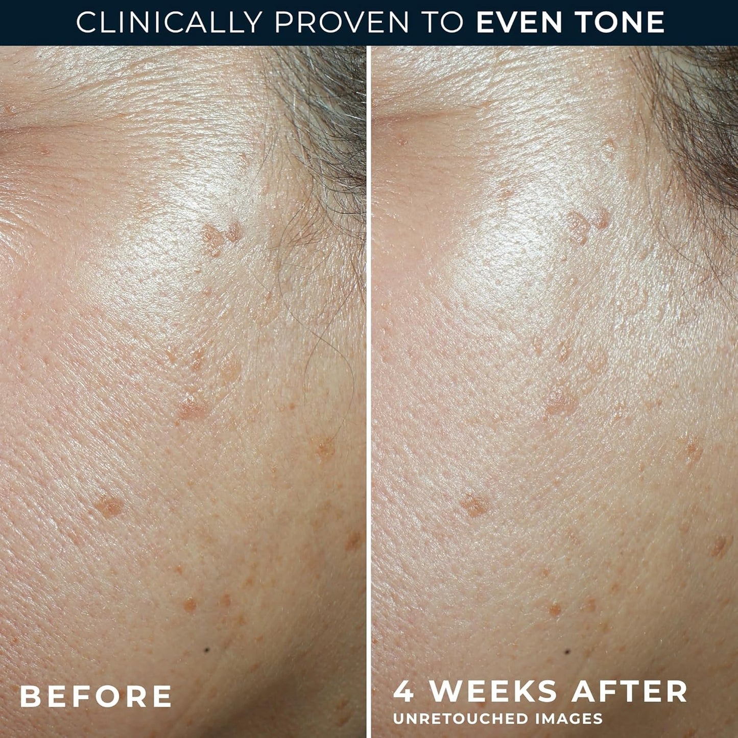 RoC Multi Correxion 5 in 1 Anti-Aging Daily Facial Moisturizer for Women and Men, Broad Spectrum SPF 30 & Shea Butter (1.7 oz) with Night Cream Packette (Packaging May Vary)